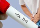 PSA test: ਹਰੇਕ ਮਰਦ 40 ਸਾਲ ਤੋਂ ਬਾਅਦ ਜ਼ਰੂਰ ਕਰਵਾਵੇ ਇਹ ਟੈਸਟ! ਸਿਹਤ ਮਾਹਿਰਾਂ ਨੇ ਦਿੱਤੀ ਸਲਾਹ