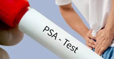 PSA test: ਹਰੇਕ ਮਰਦ 40 ਸਾਲ ਤੋਂ ਬਾਅਦ ਜ਼ਰੂਰ ਕਰਵਾਵੇ ਇਹ ਟੈਸਟ! ਸਿਹਤ ਮਾਹਿਰਾਂ ਨੇ ਦਿੱਤੀ ਸਲਾਹ
